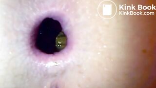 Huge shitty gape, ScatKings.com Scat Porn 5 ScatKings.com Scat Porn