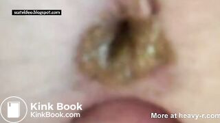 Liquid Shit Anal Fuck, ScatKings.com Scat Porn 15 ScatKings.com Scat Porn
